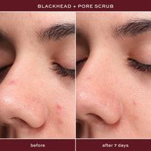 ITK Skincare Blackhead and Pore Scrub Exfoliating, Skincare Treatment with Salicylic Acid, 0.5fl oz