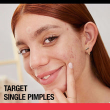 Neutrogena Stubborn Acne Blemish Patches, 24 ct., 3 pk.