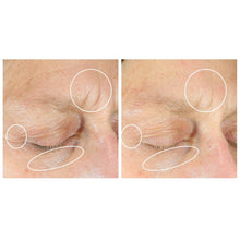 StriVectinAnti-WrinkleIntensiveEyeConcentratePlus2-_3_dfc4080d-5941-4f1b-8703-daa727be635d - USA Mega Market