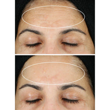 StriVectinSuperCRetinolSerum_1.0floz_0.5floz4 - USA Mega Market